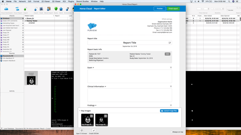 Horos Cloud Reporting